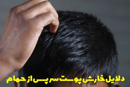 Causes of itchy scalp after bathing