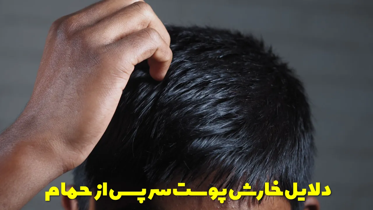 Causes of itchy scalp after bathing