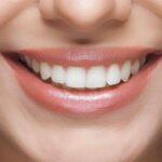 Choice of laminate or composite