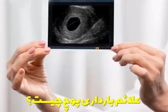 What are the symptoms of false pregnancy?