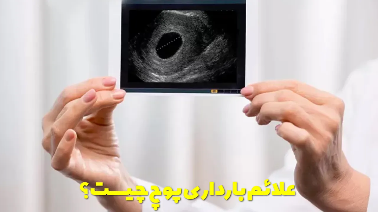 What are the symptoms of false pregnancy?